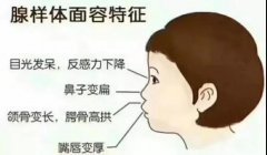 关于腺样体肥大你真的了解么？