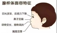 肥大的腺样体与鼻窦炎之间存在怎样的关系呢？
