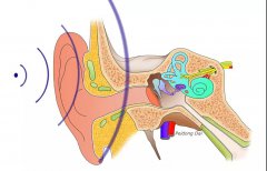 【科普系列】听力下降有可能是耳硬化症在作怪