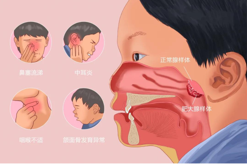 重庆耳鼻喉医院