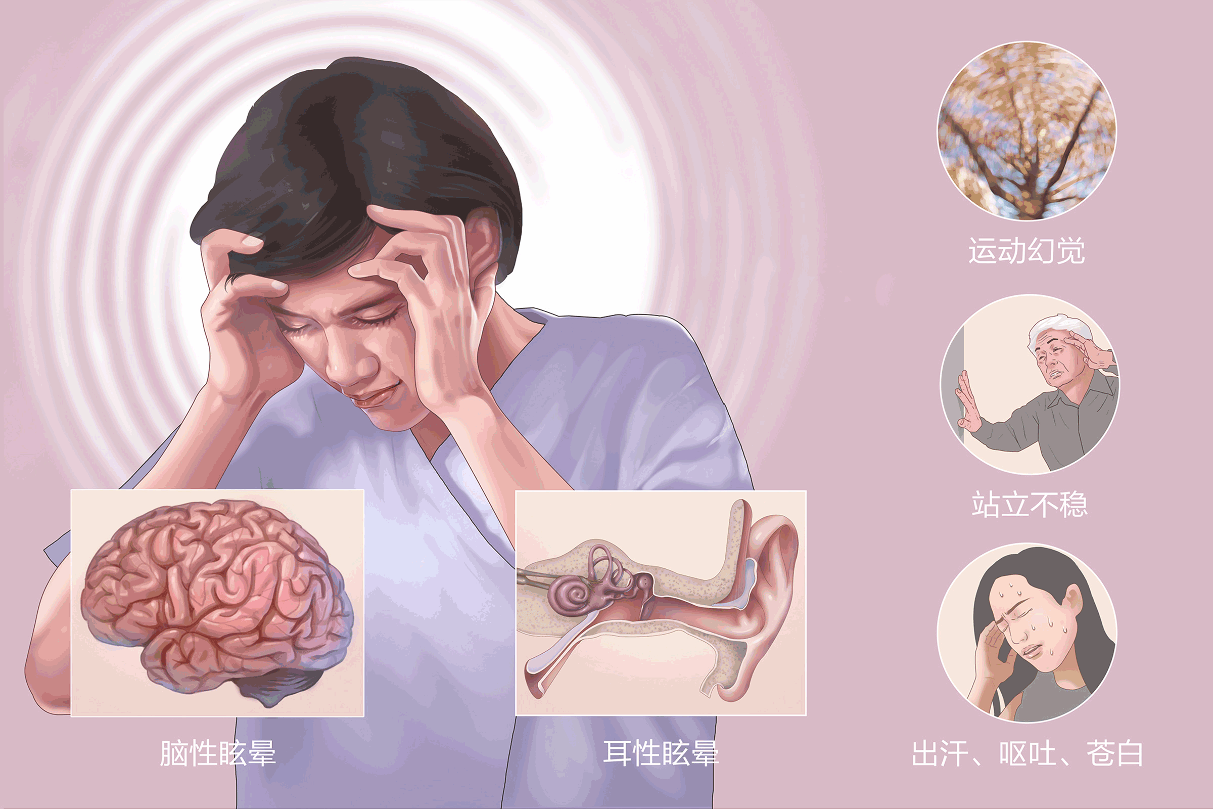 梅尼埃病