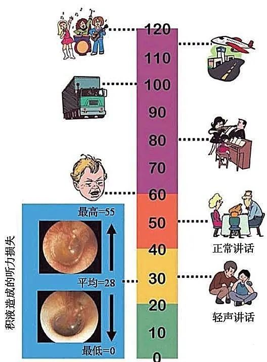 听力