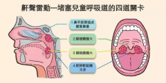 <b>儿童扁腺术后饮食：重庆仁品耳鼻喉医院的详细指导</b>