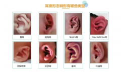 <b>不做手术矫正小耳畸形，时间上是很重要，错过至少等6年，孩子还得经历手术</b>