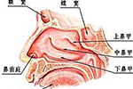 <b>鼻窦炎的发病原因有哪些?为什么总是反复难愈</b>
